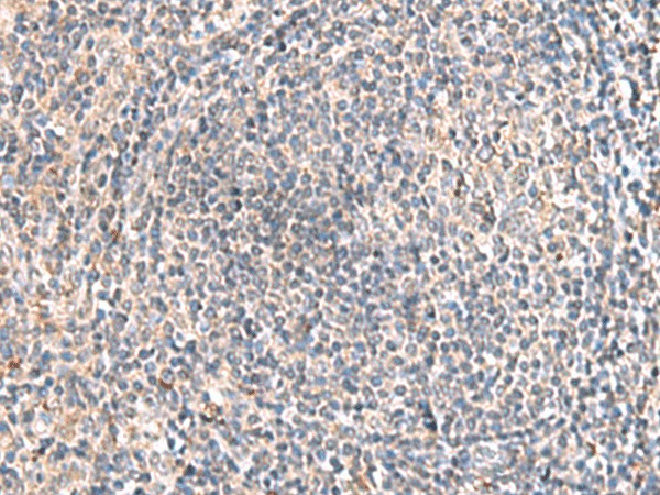 Immunohistochemistry of paraffin-embedded Human tonsil tissue  using HLA-DOB Polyclonal Antibody at dilution of 1:45(?200)