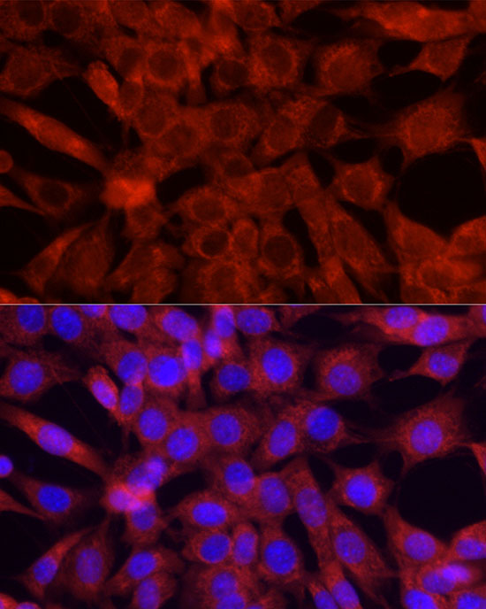 Immunofluorescence analysis of NIH/3T3 cells using Cytochrome C Polyclonal antibody  at dilution of 1:50 (40x lens). Blue: DAPI for nuclear staining.