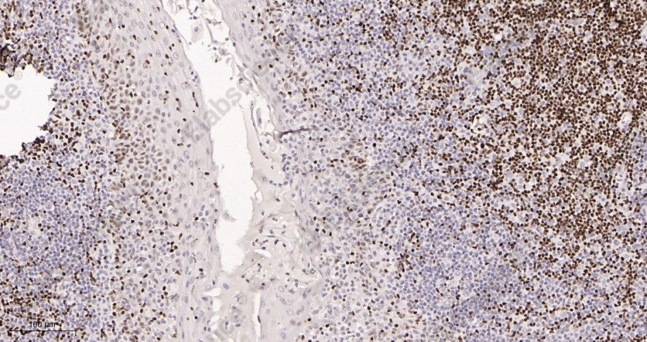 Recombinant Ctip2 Monoclonal Antibody - 2
