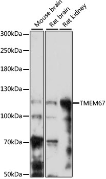 Western blot analysis of extracts of various cell lines using TMEM67 Polyclonal Antibody at 1:1000 dilution.