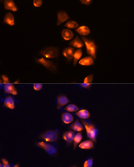 Immunofluorescence analysis of Hela cells using TIM-3/HAVCR2 Polyclonal Antibody at dilution of  1:100 (40x lens). Blue: DAPI for nuclear staining.