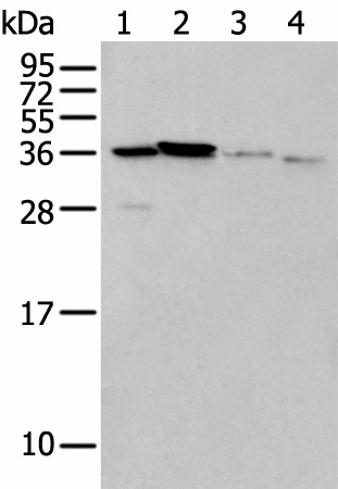 Western blot analysis of 293T cell Mouse brain tissue and Human kidney tissue lysates  using LASP1 Polyclonal Antibody at dilution of 1:350