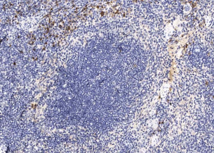 IL12B Monoclonal Antibody-searchlist-1