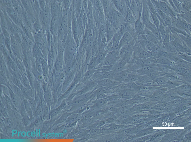 Human Cardiac Fibroblast Complete Medium - 4