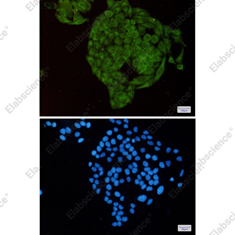 Recombinant MTH1 Monoclonal Antibody - 2