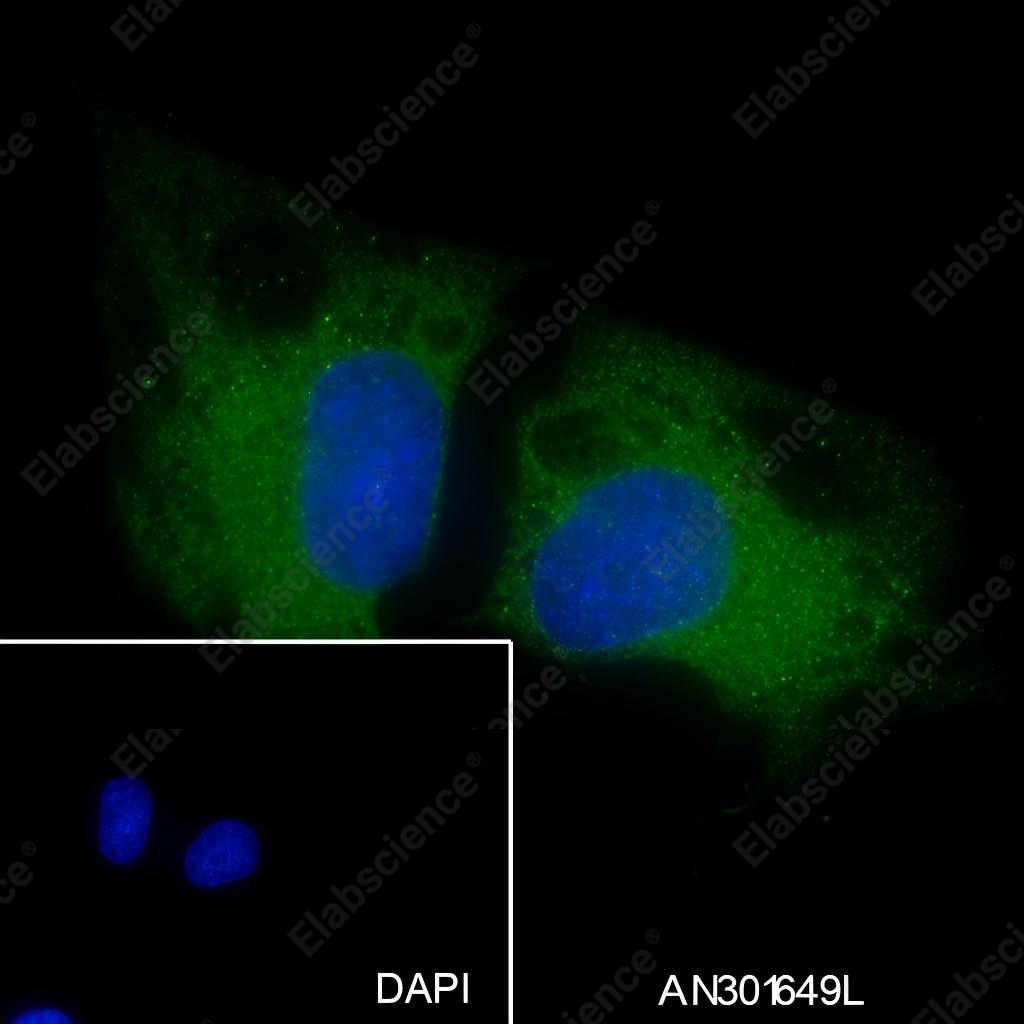 Recombinant ROCK2 Monoclonal Antibody - 4