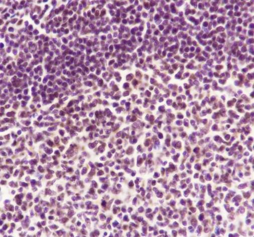 Recombinant SA2 Monoclonal Antibody - 3