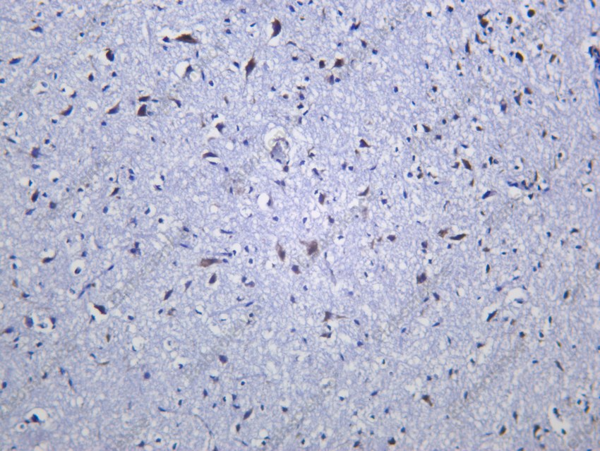 Recombinant EIF2S1 Monoclonal Antibody - 2