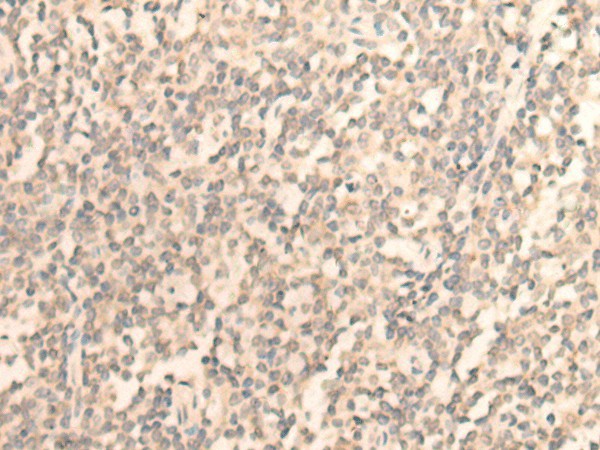 Immunohistochemistry of paraffin-embedded Human tonsil tissue  using DAZ1 Polyclonal Antibody at dilution of 1:55(?200)