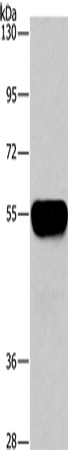 Western Blot analysis of Human plasma tissue using AHSG Polyclonal Antibody at dilution of 1:1450