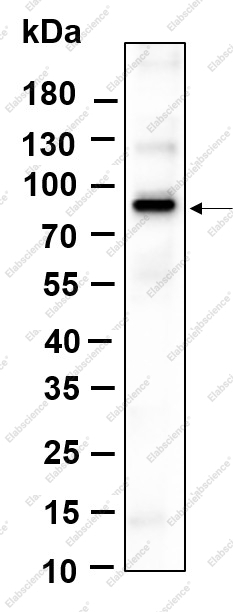 Recombinant Phospho-β Catenin (Ser37) Monoclonal Antibody - 1