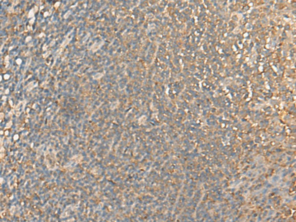 DGLUCY Polyclonal Antibody - small - 2