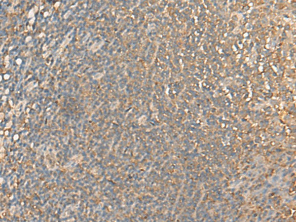 Immunohistochemistry of paraffin-embedded Human tonsil tissue  using DGLUCY Polyclonal Antibody at dilution of 1:40(?200)