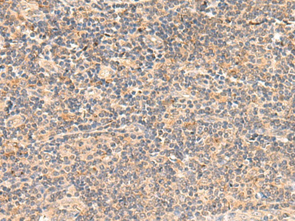 Immunohistochemistry of paraffin-embedded Human tonsil tissue  using TEAD3 Polyclonal Antibody at dilution of 1:50(?200)