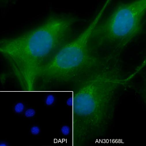 Recombinant SOD1 Monoclonal Antibody - small - 6