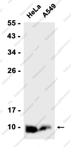 Recombinant Ubiquitin K63 Monoclonal Antibody - 1
