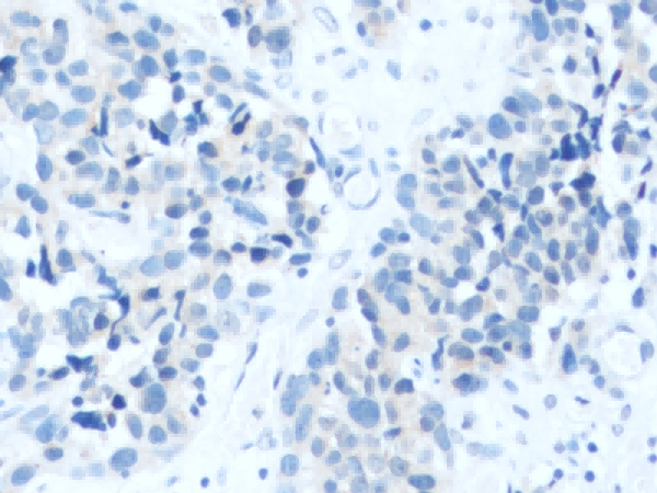 RGS1 Polyclonal Antibody - 3