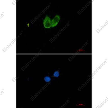 Recombinant ZYX Monoclonal Antibody - 4