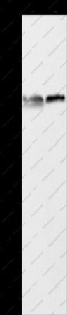 ALAS2 Polyclonal Antibody - 1