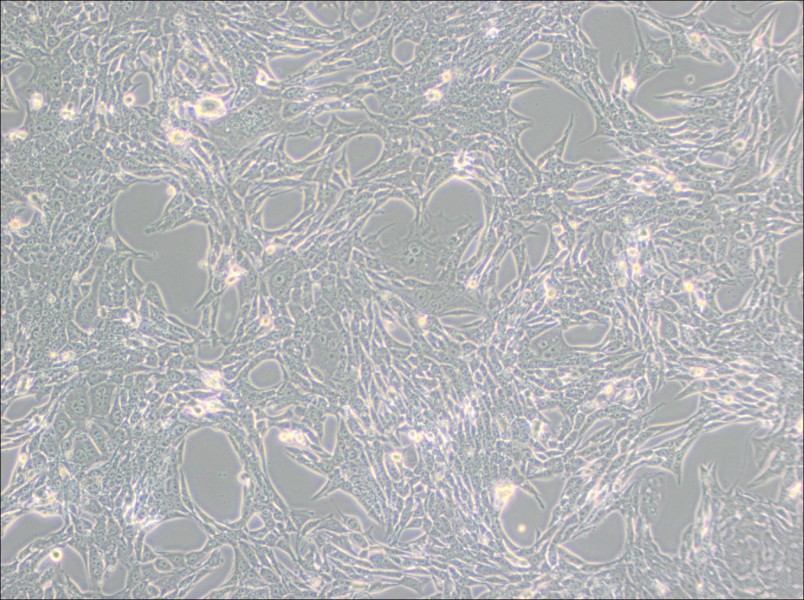 Renca [RenCa] Cell Complete Medium - small - 2