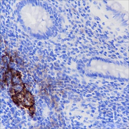 Recombinant CD35 Monoclonal Antibody-searchlist-1