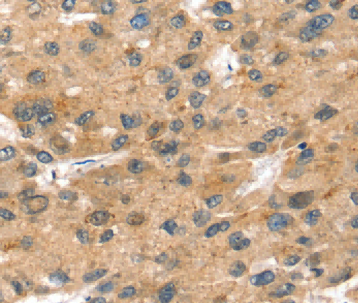 SORT1 Polyclonal Antibody - 2
