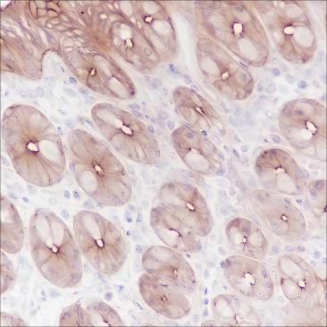 Recombinant FGFR2 Monoclonal Antibody - 2