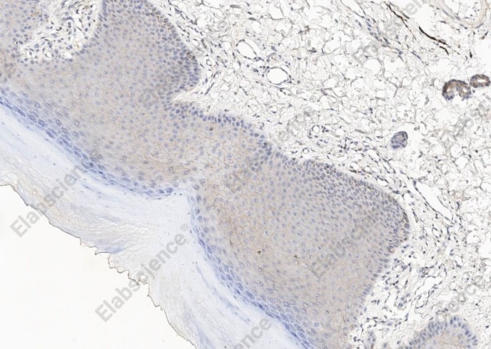 TROP2/TACSTD2 Monoclonal Antibody - 6