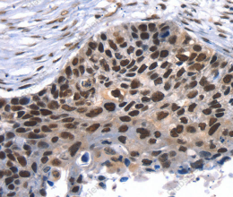 TAF15 Polyclonal Antibody - 3