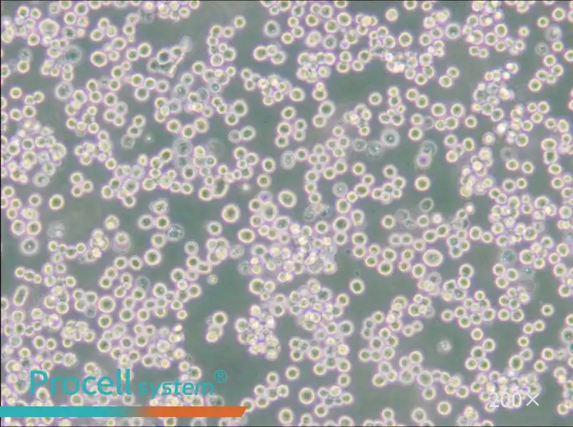 LLC-WRC 256 [Walker 256] Cell Complete Medium - 6