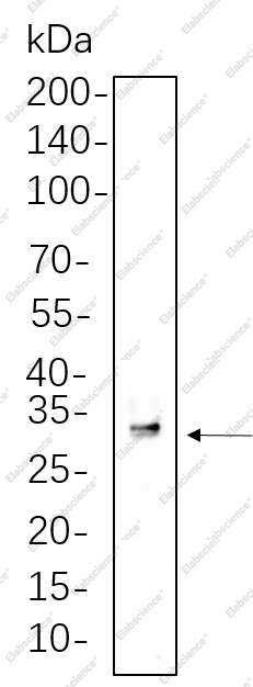 Recombinant SDHB Monoclonal Antibody - 1