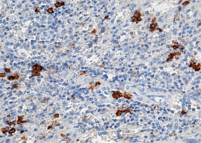 Recombinant CD38 Monoclonal Antibody - small - 2