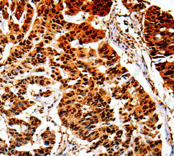 AKR1B1 Polyclonal Antibody - 2