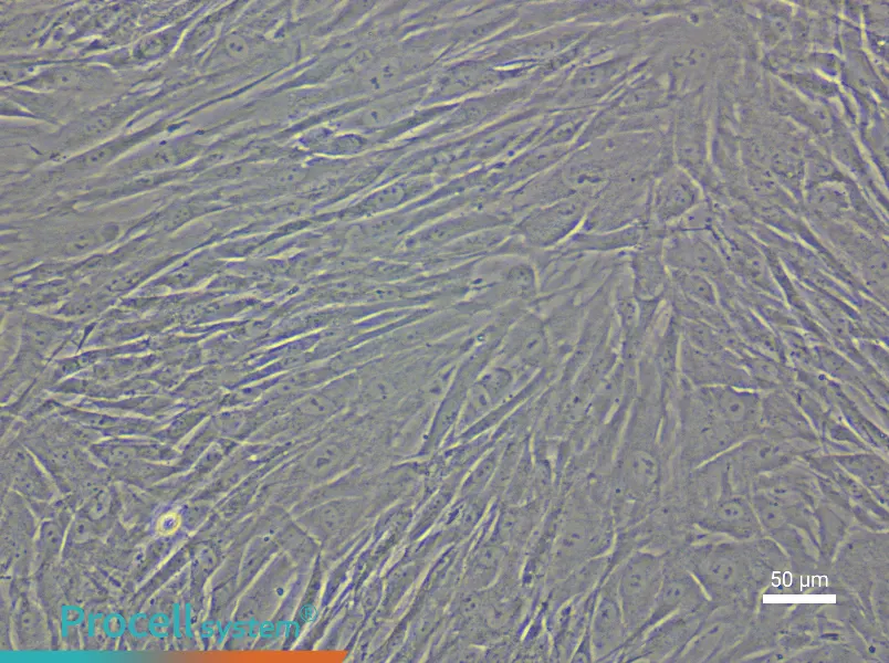 Human Esophageal Fibroblast Complete Medium - 6
