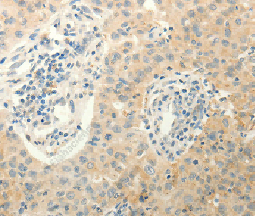 ERG Polyclonal Antibody - 3