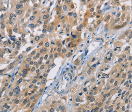 CBR1 Polyclonal Antibody - 3