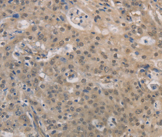 DPYSL3 Polyclonal Antibody - 3