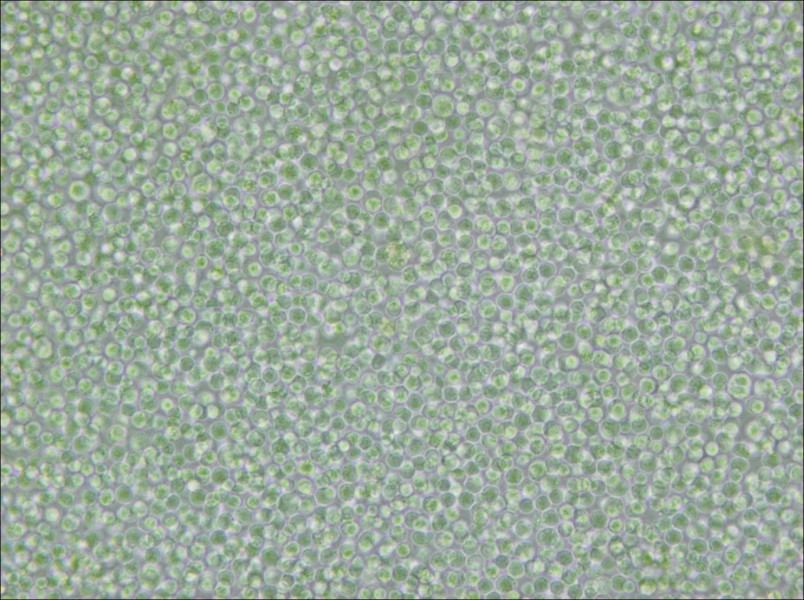 SU-DHL-4 Cell Complete Medium - 4