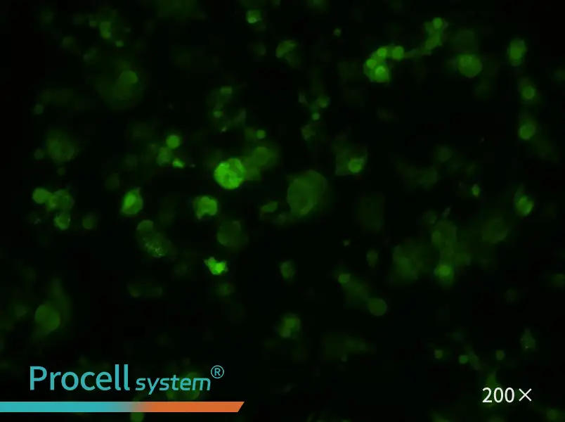 HePa1-6-GFP Cell Complete Medium - 1