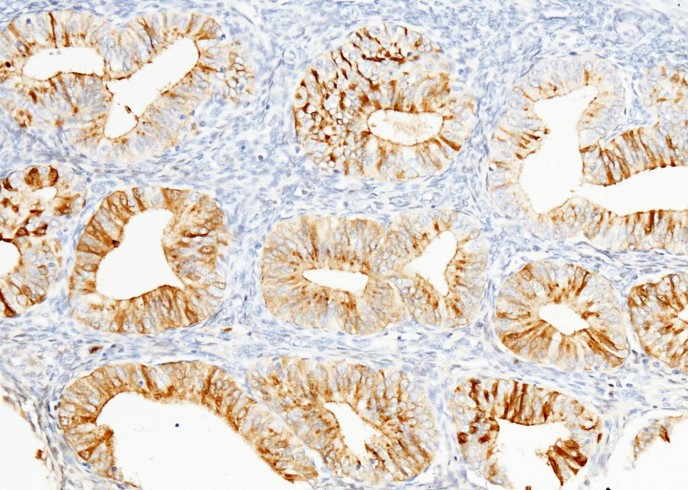 Recombinant WAP5/WFDC2/HE4 Monoclonal Antibody - small - 2