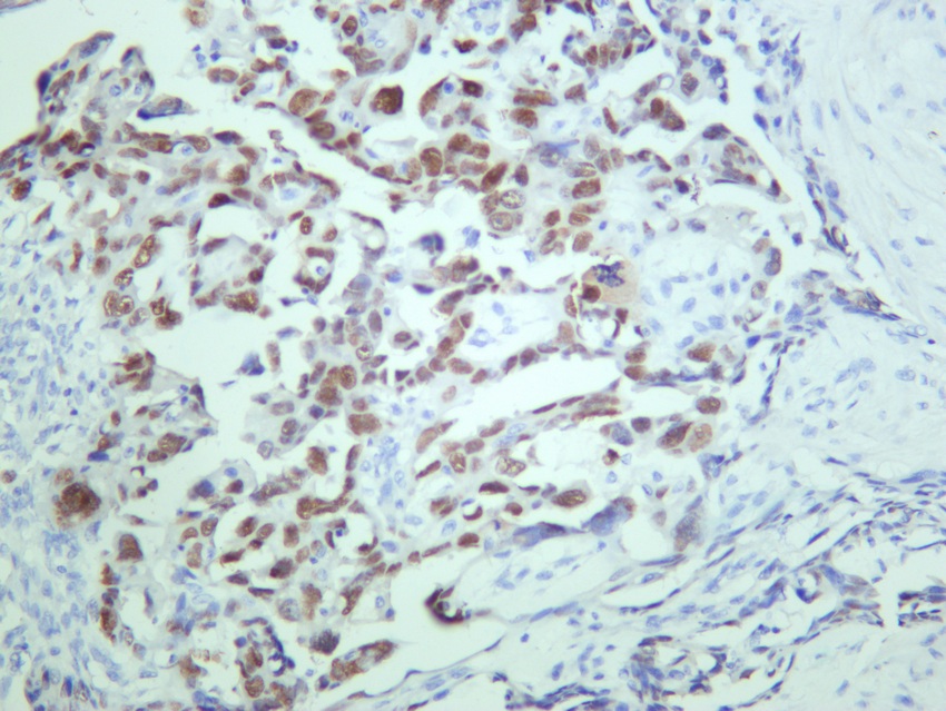 Recombinant p53 Monoclonal Antibody - small - 5