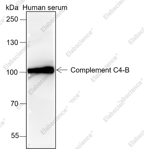 Recombinant Complement C4-B Monoclonal Antibody - 1