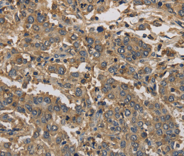 KIF22 Polyclonal Antibody - 3