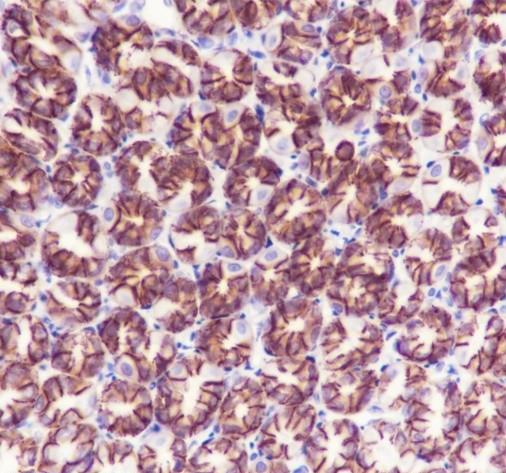 Recombinant Non-Phospho (Active) β-Catenin (Ser33, Ser37, Thr41) Monoclonal Antibody - small - 4