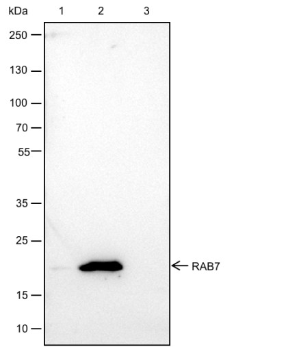 Recombinant Rab7 Monoclonal Antibody - small - 3