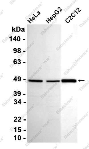 Recombinant PDK2 Monoclonal Antibody - 2