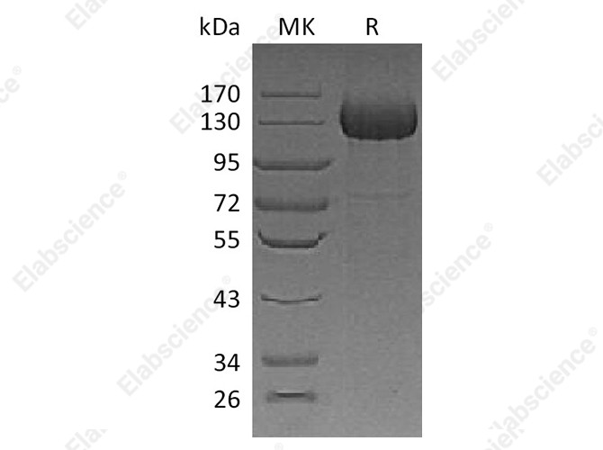 Recombinant Human CDO/CDON Protein (His Tag) - 1