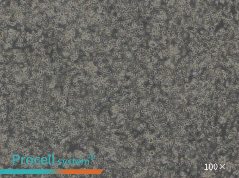 MEC-1 Cell Complete MediumMEC-1 Cell Complete Medium - 2