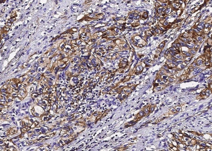 S100A10 Monoclonal Antibody - small - 3