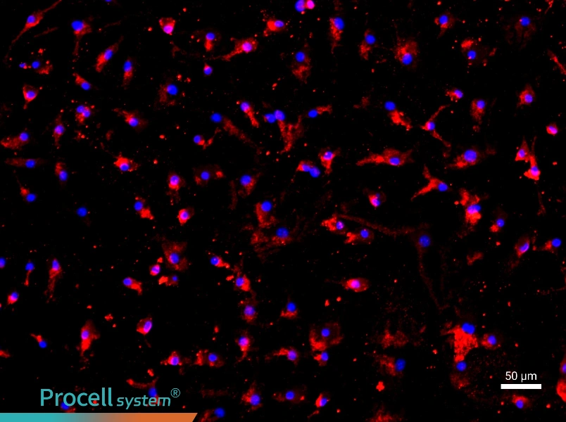 Rat Pulmonary Microvascular Endothelial Cell Complete Medium - 1